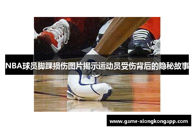 NBA球员脚踝损伤图片揭示运动员受伤背后的隐秘故事